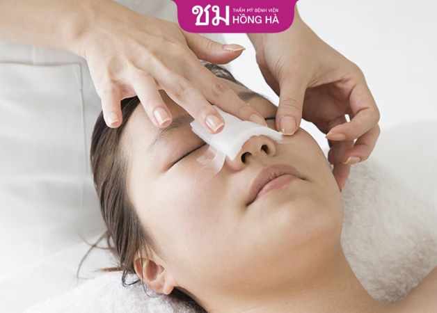 Thực hiện nâng mũi bọc sụn