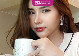 Cắt mí bao nhiêu tiền – 4 yếu tố quyết định đến giá cắt mí