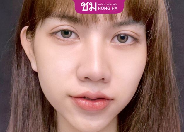 Lựa chọn đơn vị thẩm mỹ có quy trình thực hiện bài bản