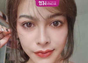 Review địa chỉ cắt mí đẹp chuẩn Thái, uy tín hiện nay