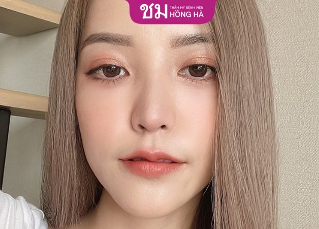 Công nghệ cắt mí đẹp Thai Eyelid