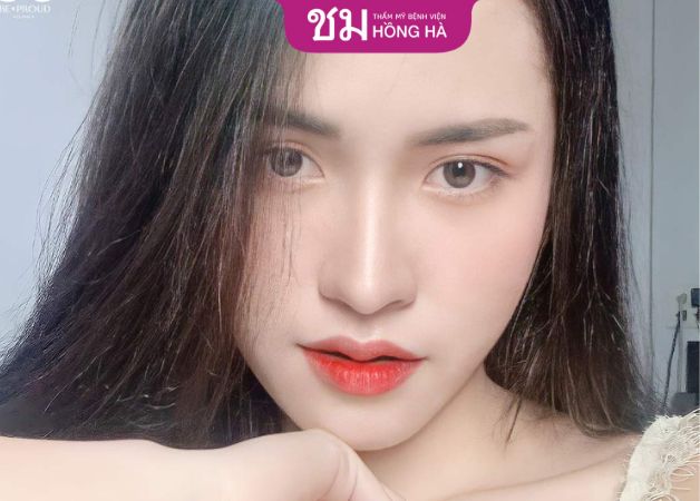 Cần tuân thủ lịch hẹn tái khám theo chỉ định của bác sĩ để theo dõi hồi phục