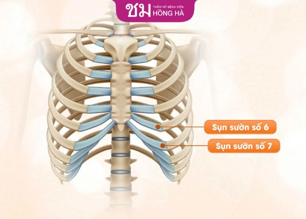 Bác sĩ sử dụng chính sụn sườn của khách hàng để nâng mũi