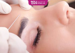 Chuyên gia giải đáp: Có nên nâng cung chân mày không