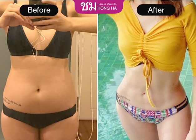 Chị Vân Anh tự tin với vòng bụng thon gọn