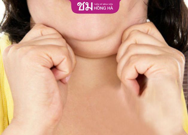 Tình trạng mỡ nọng cằm của khách hàng cũng ảnh hưởng đến giá dịch vụ