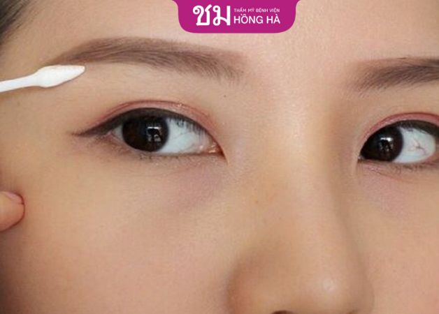 Thẩm mỹ BV Hồng Hà là địa chỉ nâng cung mày uy tín
