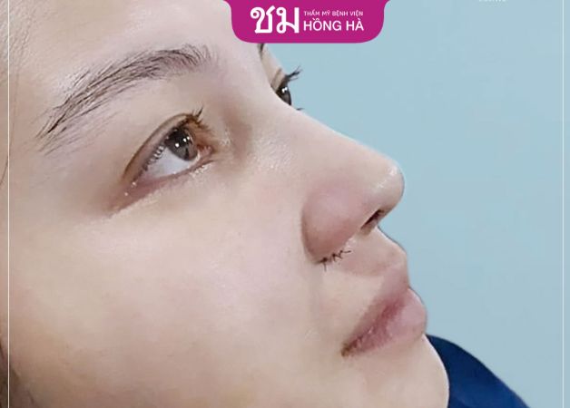 Khách hàng không phải lo lắng tụt sụn