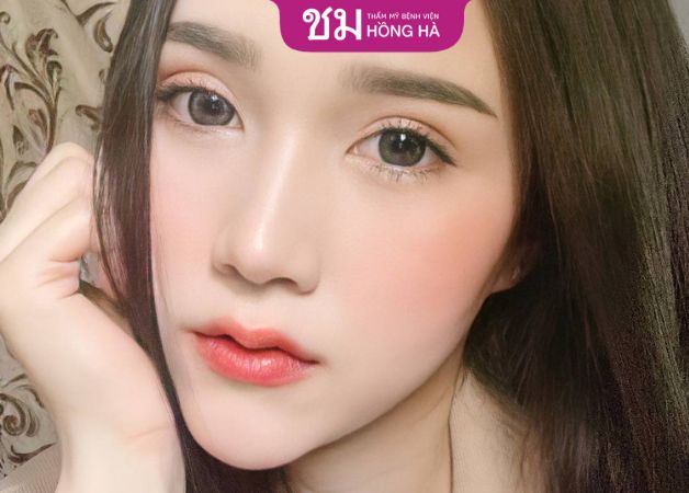 Đây là phương pháp thẩm mỹ mũi an toàn