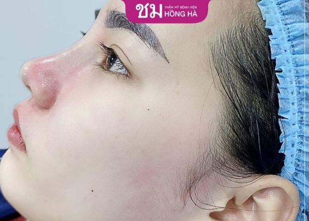 Ghi nhớ lịch hẹn tái khám từ bác sĩ