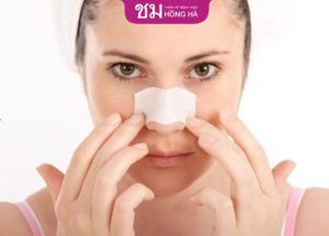 Nâng mũi sụn nhân tạo giữ được bao lâu-Bác sĩ thẩm mỹ trả lời