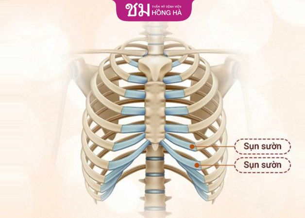 Sử dụng sụn sườn của chính khách hàng để đảm bảo nâng mũi không kích ứng