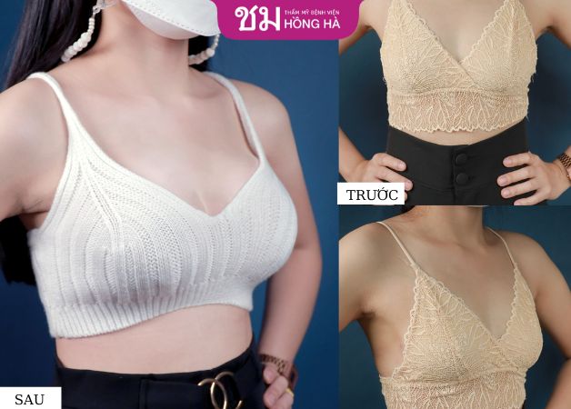 Khách hàng biến đổi với vòng 1 căng tròn đẫy đà