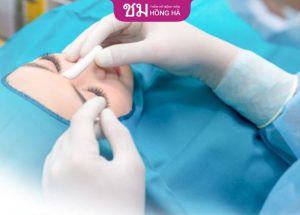 Phẫu thuật thẩm mỹ nâng mũi – Sở hữu dáng mũi chuẩn tỷ lệ vàng