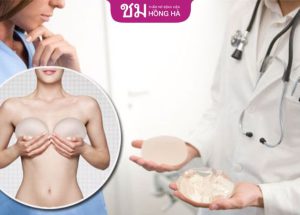 Nâng ngực size nhỏ nhất: 3 Lưu ý chọn đúng size túi ngực