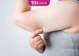 Giảm mỡ bắp tay hiệu quả với 7 cách đơn giản, tại nhà