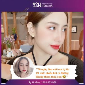 Nâng mũi cấu trúc ở đâu đẹp? Review của khách hàng