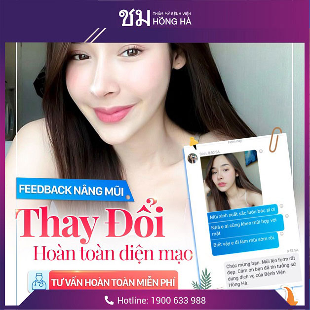 Thay đổi diện mạo sau khi nâng mũi