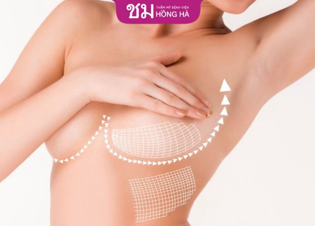 Chị em cần ghi nhớ những lưu ý khi nâng cấp vòng 1