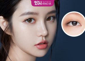 Bấm mí bao nhiêu tiền – 4 Yếu tố ảnh hưởng chi phí