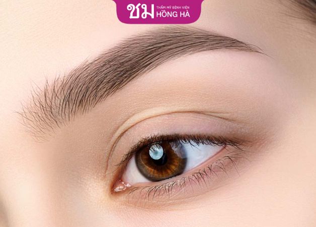 7-10 ngày thời gian hồi phục sau khi bấm mí