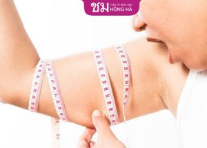 Bệnh viện nào hút mỡ bắp tay an toàn và hiệu quả nhất