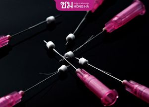 5 loại chỉ căng da mặt an toàn, thông dụng hiện nay