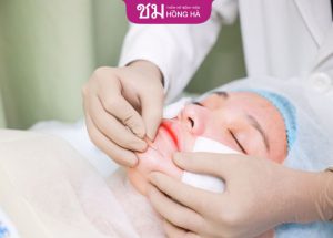 Căng da mặt bao lâu thì lành? Giải đáp từ bác sĩ thẩm mỹ