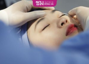 Cắt mí: Sở hữu đôi mắt to, tự nhiên chỉ sau 60 phút