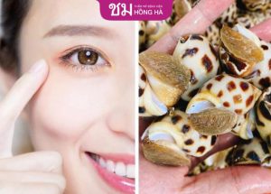 Cắt mí ăn ốc được không – 3 loại hải sản không nên ăn sau cắt mí