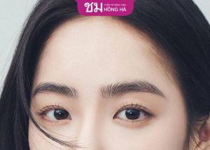 Cắt Mí Thái Lan Hồng Hà: Bí quyết để có đôi mắt to tròn, long lanh