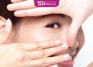 Cách chườm đá sau khi cắt mí giúp giảm sưng, đau cấp tốc