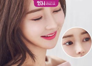 Cắt mí có nguy hiểm không – 5 lưu ý đảm bảo an toàn sau cắt mí