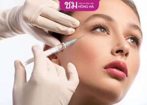 Cấy mỡ mặt – Trẻ hóa toàn diện an toàn và lâu dài