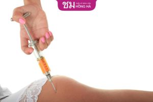 Cấy mỡ mông – Giải pháp làm đầy vòng 3 an toàn, hiệu quả