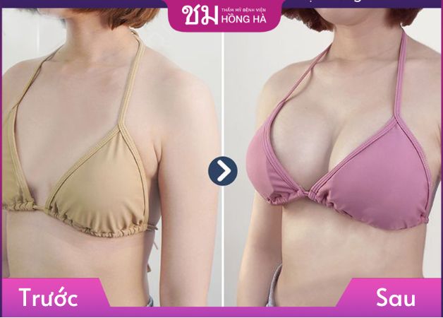 Khách hàng sở hữu dáng ngực đẹp với khe sâu sexy