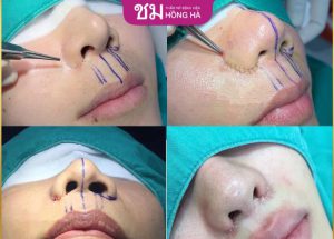 Cuộn cánh mũi có phá tướng không? Có mất lộc không?