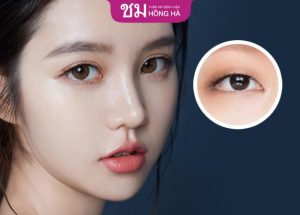 Hồng Hà – Địa chỉ cắt mí đẹp ở Hà Nội và Tp. Hồ Chí Minh