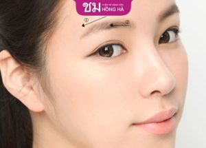 Thẩm mỹ Bệnh viện Hồng Hà – Địa chỉ nâng cung chân mày uy tín