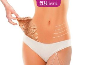 Hút mỡ bụng dưới dưỡng bao lâu? Cách chăm sóc đúng chuẩn
