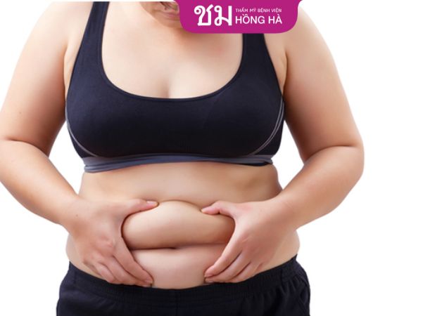 Đa số chị em sau sinh thường có mỡ bụng