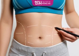 Hút mỡ có đau không? Cách giảm đau sau hút mỡ