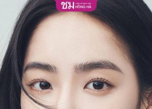 Bấm mí Thai Eyelid – Giải pháp kiến tạo mắt 2 mí đẹp tự nhiên