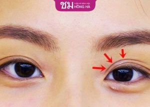 Mắt 3 mí có đẹp không? Nhân tướng học nói lên điều gì