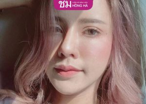 Môi hình cánh cung: Luận giải vận mệnh tốt hay xấu, sang hay hèn