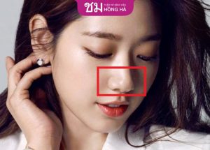 Tất tần tật những điều cần biết về dáng mũi chẻ