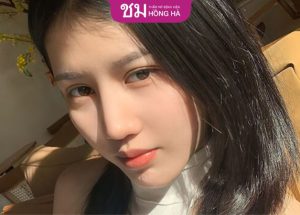 Tìm hiểu những điểm nổi bật của người có mũi dọc dừa