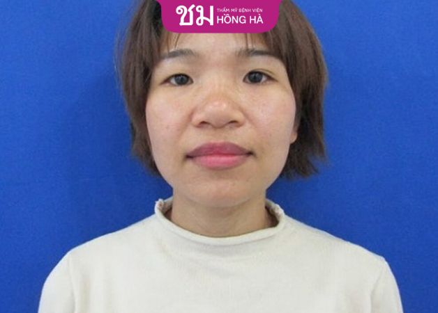 Nữ giới sở hữu mũi ngắn thường trắc trở trong chuyện tình cảm