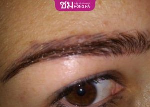 Nâng cung mày bị hỏng biểu hiện như nào? Cách khắc phục hiệu quả