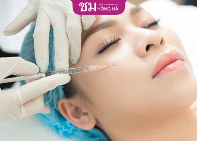 Nâng cao gò má không cần phẫu thuật